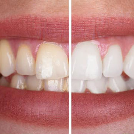 Zahnheilkunde Koblenz